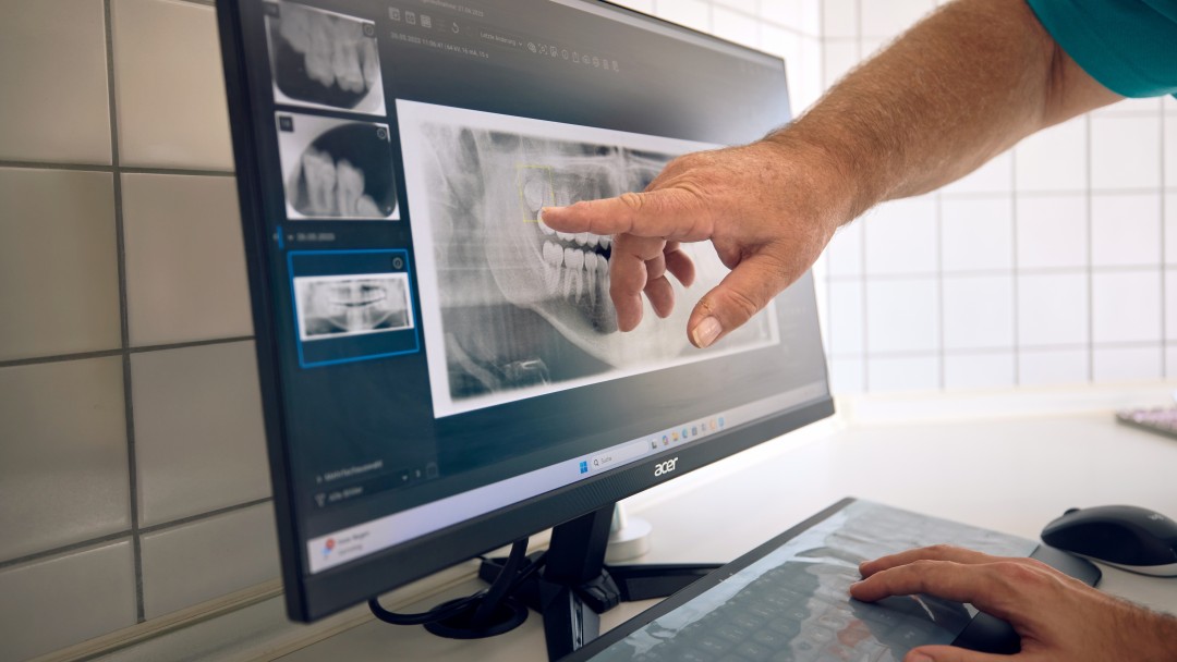 Micheal Feulner mit Dr. Franz-Werner Krieger bei der Begutachtung einer Röntgenaufnahme an einem Computer